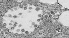SARS和新的冠状病毒瞄准相同的细胞锁来感染细胞