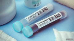 抗体测试是如何起作用的，沐鸣注册登录能否帮助对抗冠状病毒