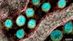 沐鸣平台登陆线路T细胞可能有助于COVID-19患者，而人们从未接触过这种病毒