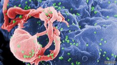 第一次，一个人的免疫系统战胜了艾滋病毒，并且取得了胜利